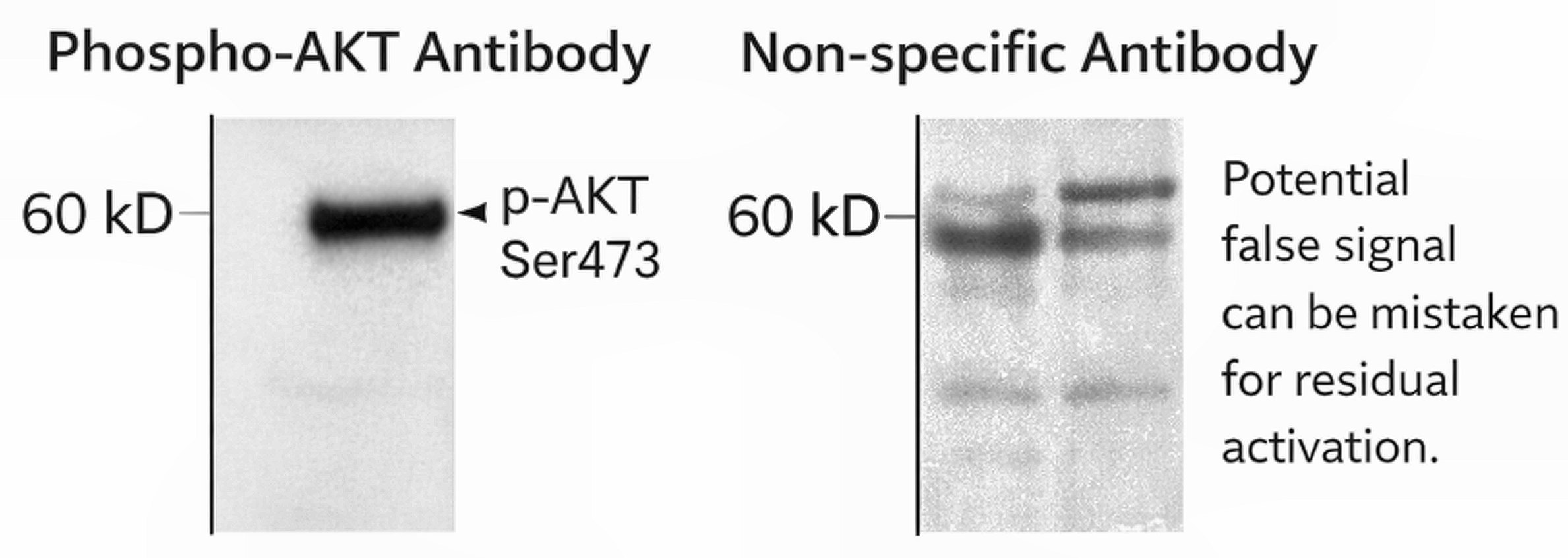 Non-specific Antibody Binding in Western Blot